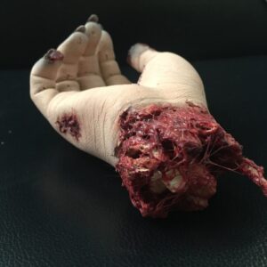 Abgerissene Hand